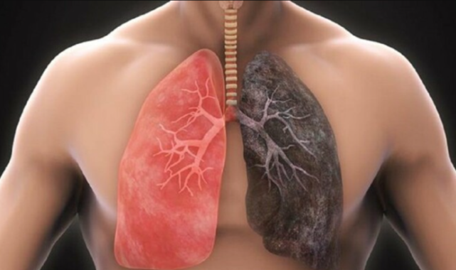 Sigara bağımlıları dikkat: 3 günde ciğerleri tertemiz yapıyor! Vücutta toksin bırakmıyor
